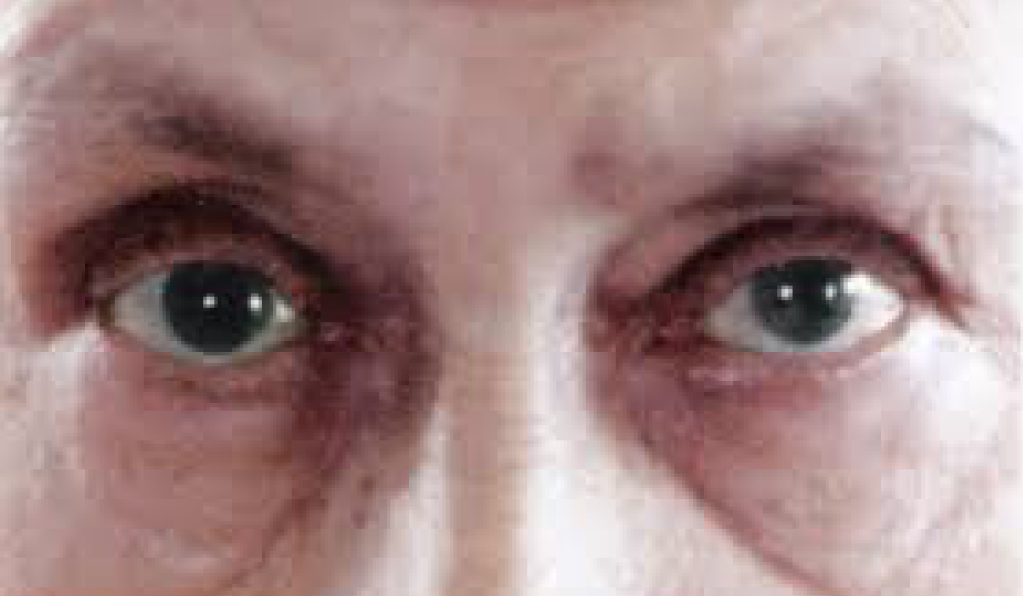 04: Scribbled Notes — Two tranquil&nbsp;eyes